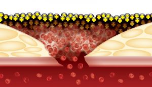 پودر و فیلم بند آورنده خون